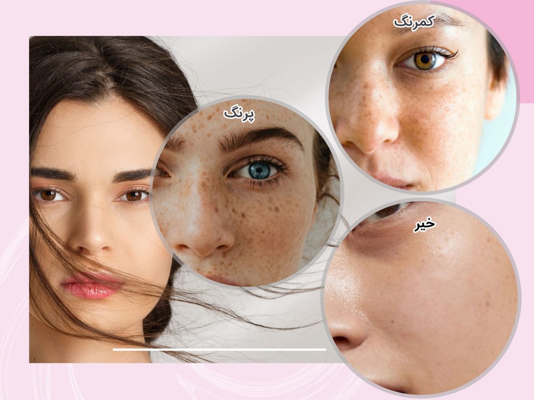 روی-سطح-پوست-نقاط-تیره-یا-قهوای-رنگ-دارید؟-min Question Image