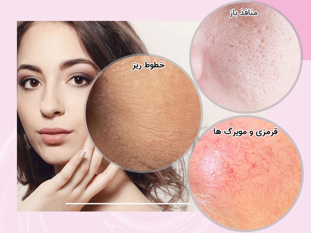 سطح-پوست-شما-چگونه-است؟--min Question Image