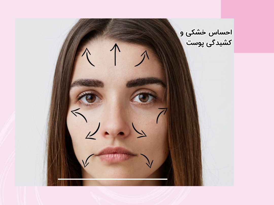 کشیدگی-min Question Image