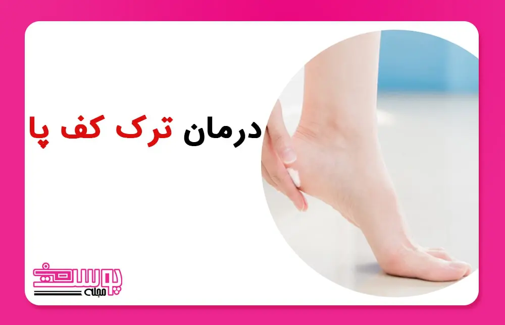 درمان ترک کف پا
