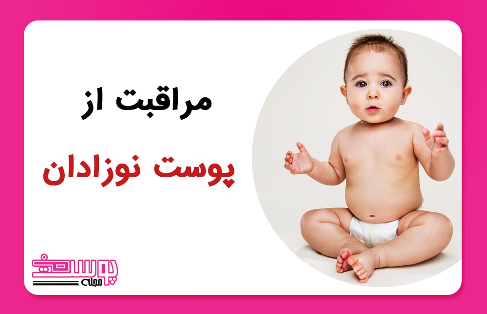 پوست نوزاد - مراقبت از پوست نوزادان