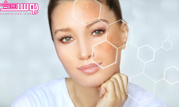 علت تیره شدن پوست صورت و بدن