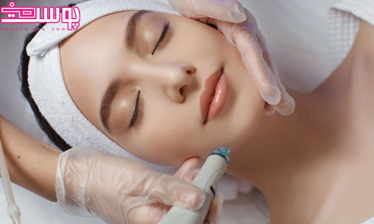 سفید شدن بدن دائمی