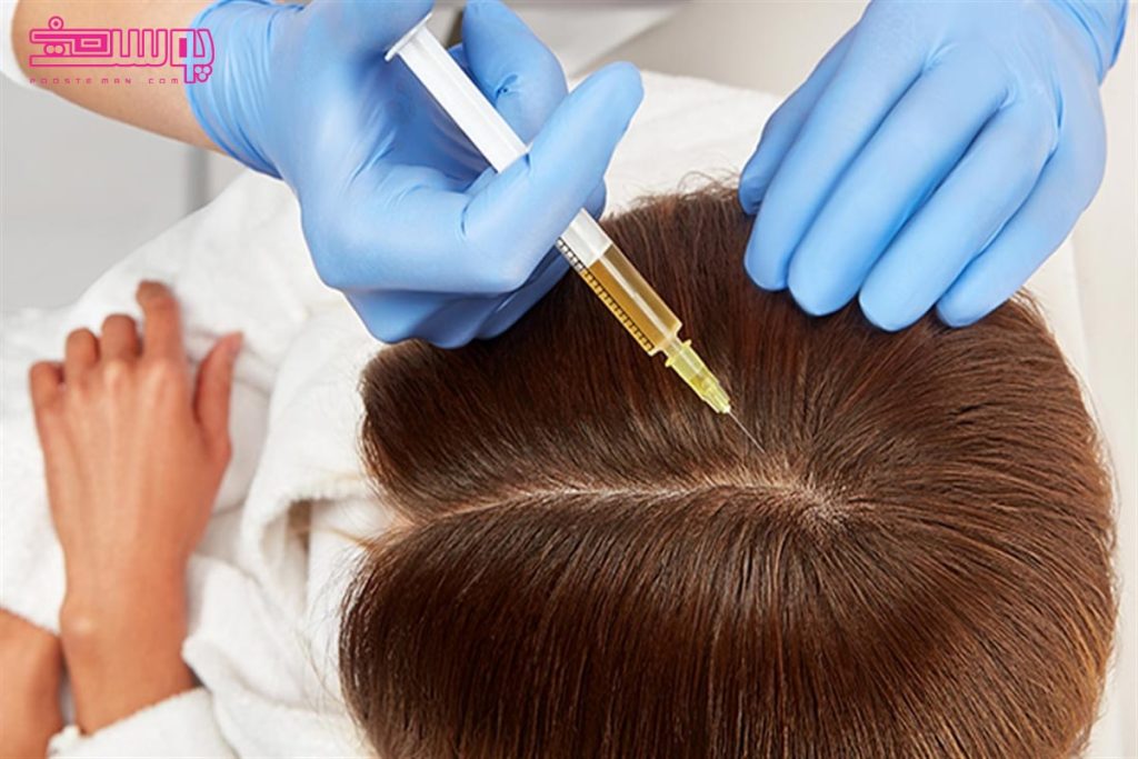 مزو تراپی مو چیست؟