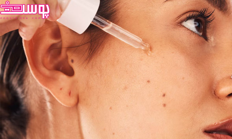 بهترین سرم ضد جوش