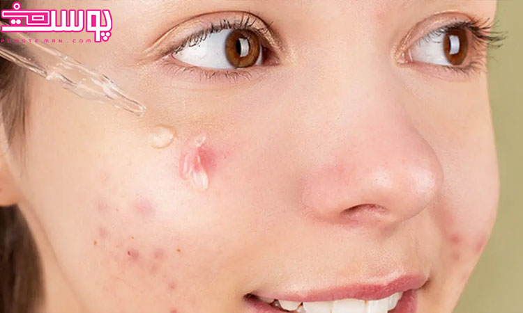 ترکیبات سرم ضد جوش قوی